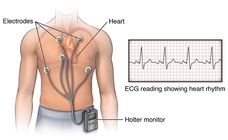 cardiac monitor