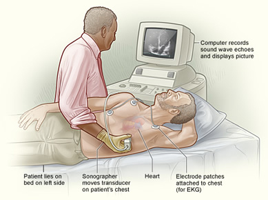 echocardiogram