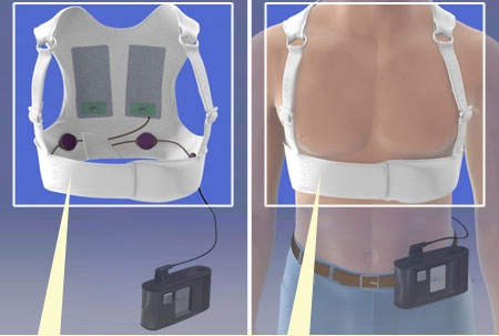 wearable defibrillator